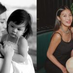 Kepala Zoe Anak Patricia Gouw Kini Lebih Baik Usai Terapi