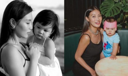 Kepala Zoe Anak Patricia Gouw Kini Lebih Baik Usai Terapi